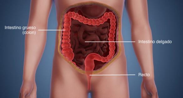 El cáncer de colon se refiere al cáncer en el colon, en el recto o en ambos.